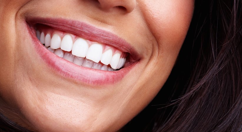 Professionelle Mundhygiene - DDr. Silvia Laudenbach - Zahnärztin Wien 1150