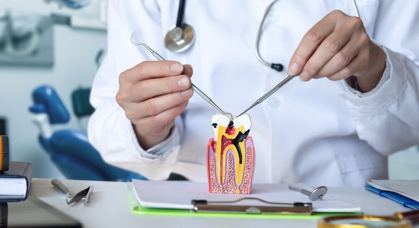 Wurzelbehandlung - DDr. Silvia Laudenbach - Zahnärztin Wien 1150