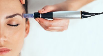 Microneedling