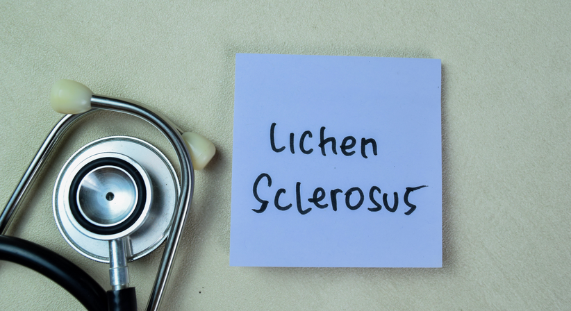 Lichen Sclerosus - Dr. Franz Roithmeier - Frauenarzt Wien 1060
