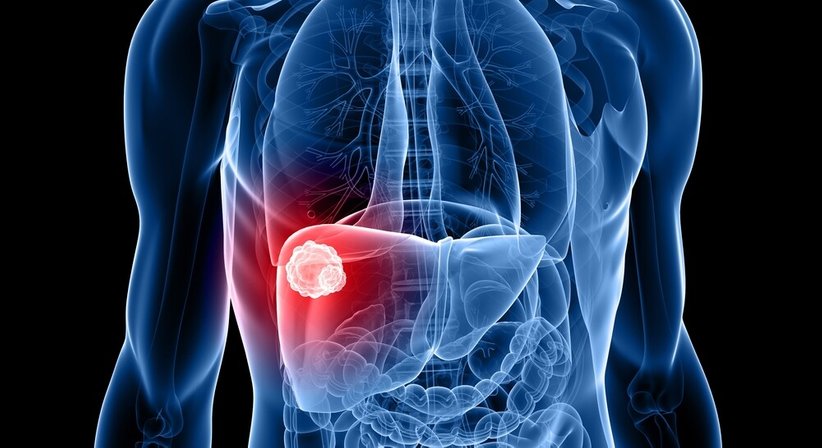 Lebererkrankungen - OA Dr. Gerhard L. Jansky - Kardiologe Salzburg 5020