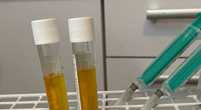 Sportmedizin, Eigenblut-Therapien