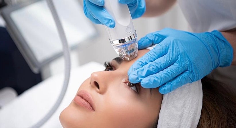 Radiofrequenz-Microneedling - Dr.med. Tatyana Hübscher - Hautärztin Wien 1010