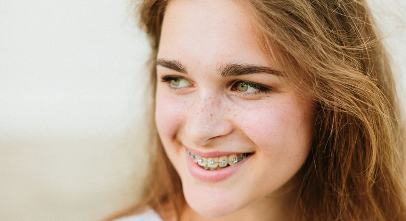 Gratiszahnspange - Dr. Alexander Gugenberger, MSc. - Zahnarzt Wien 1010