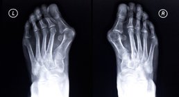 OA Dr. Thomas Kolp - Orthopäde Korneuburg 2100