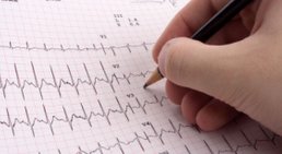 EKG -