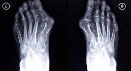OA Dr. Ralph Schmid - Orthopäde Wiener Neustadt 2700