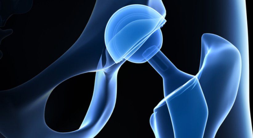 Hüftschmerzen - OA Dr. Ralph Schmid - Orthopäde Wiener Neustadt 2700