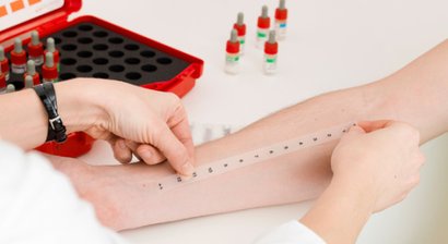 Allergieabklärung