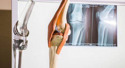 Künstliches Kniegelenk