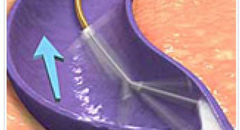 Venenbehandlungen - Dr. Bettina Wiltos - Allgemeinchirurgin Mödling 2340