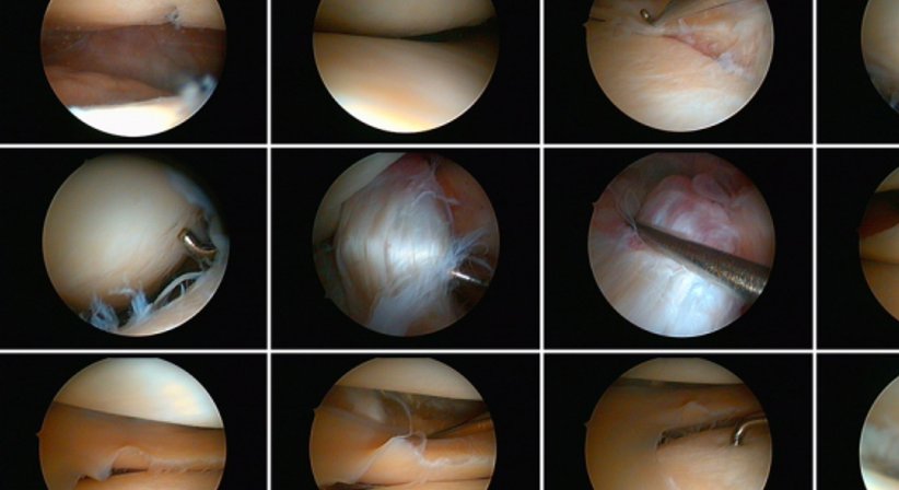 Arthroskopie - Prim. Dr. Peter Zenz - Orthopäde Wien 1130