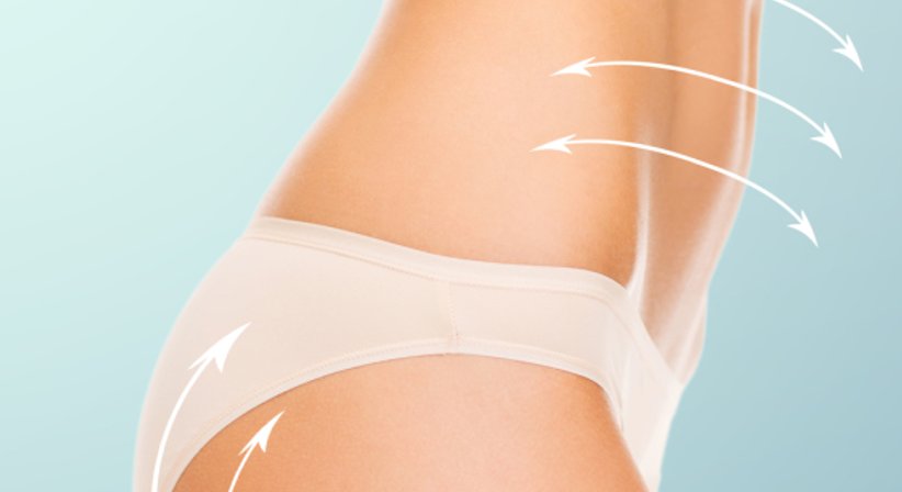 Fettabsaugung - OA Dr. Rene Kaplan - Plastischer Chirurg Linz 4020