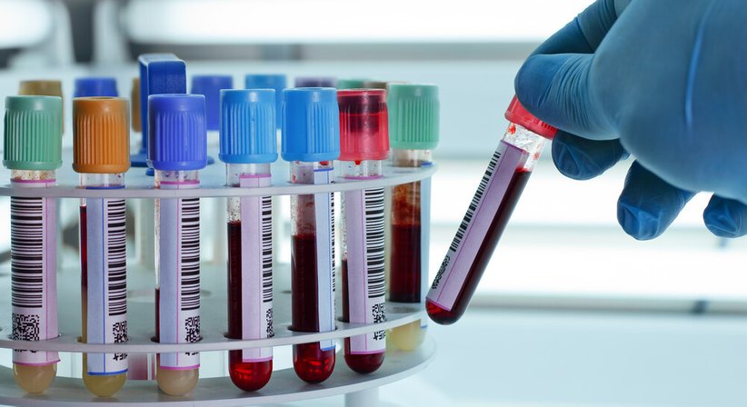 Abklärung von Lebererkrankungen mittels Labor und Ultraschall Fettleber - Dr. Mark Schneider - Internist Wien 1040