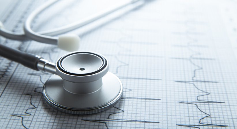 Elektrokardiogramm - Dr. Mark Schneider - Internist Wien 1040