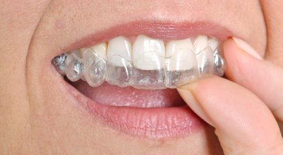 Schienentherapie (Aufbiss- / Knirscherschiene)