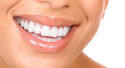 Unsichtbare Zahnspange/ Aligner nach der Invisalign-Methode