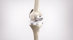 OA Dr. Georg Brandl - Orthopäde Wien 1130