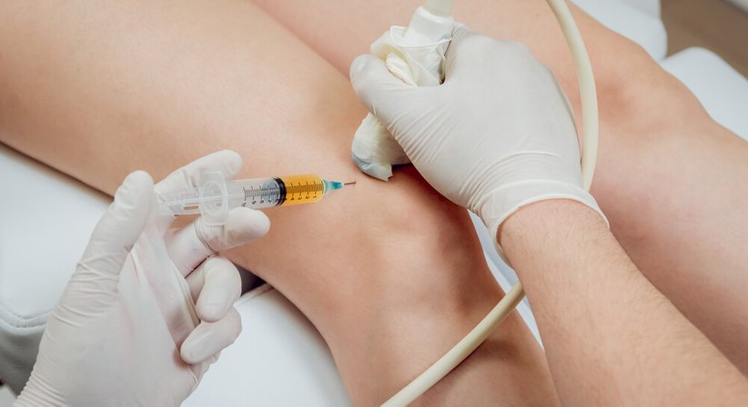 PRP-Therapie - OA Dr. Georg Brandl - Orthopäde Wien 1130