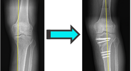 OA Dr. Georg Brandl - Orthopäde Wien 1130