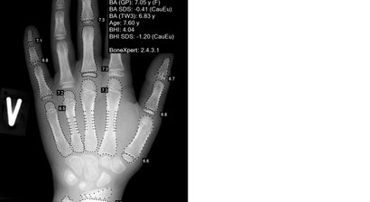 Bestimmung der Endgröße