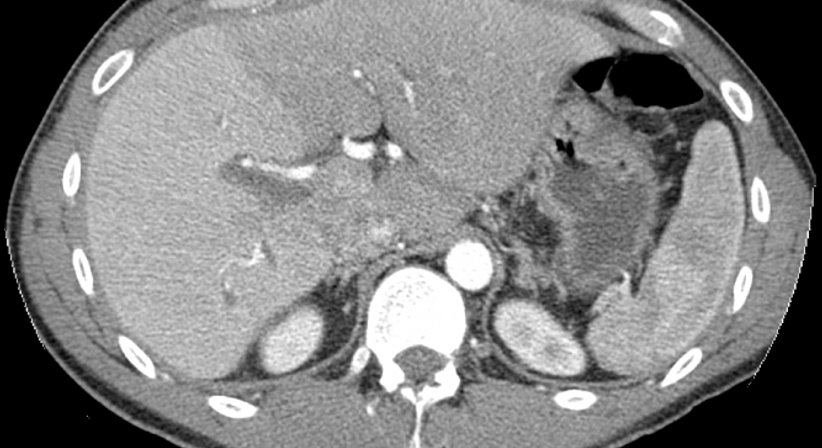 Computertomographie - Dr. Axel Gebauer - Radiologe Baden 2500