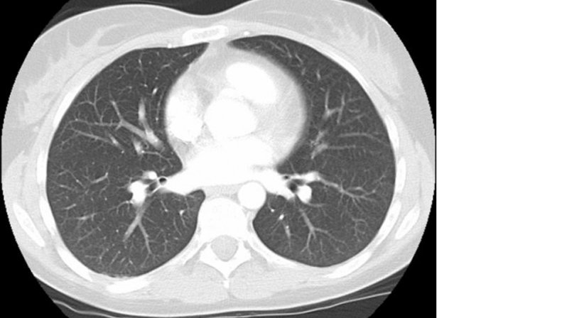 Computertomographie - Dr. Axel Gebauer - Radiologe Baden 2500