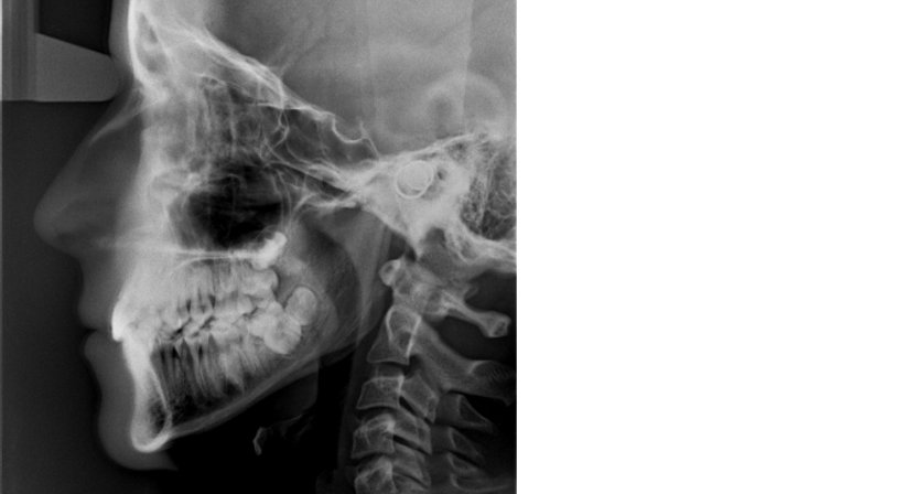 Fernröntgen - Dr. Axel Gebauer - Radiologe Baden 2500