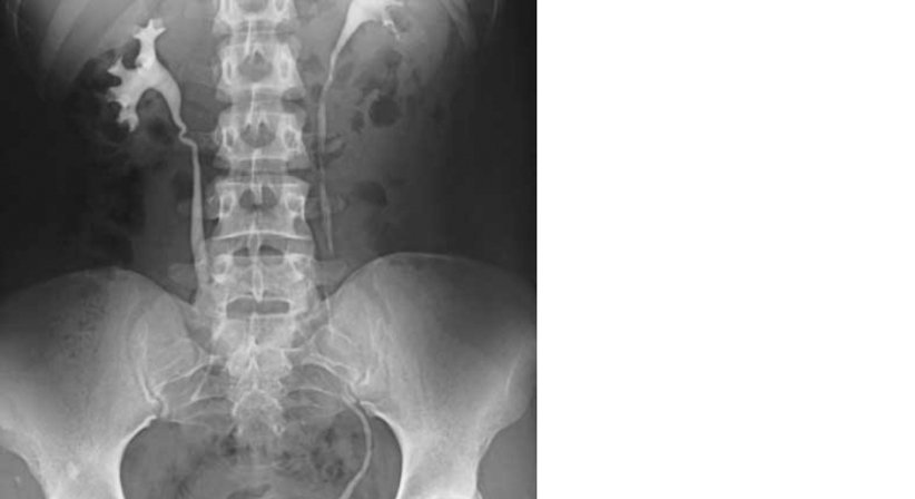 Kontrastmitteluntersuchungen von Magen, Darm, Nieren und Venen - Dr. Axel Gebauer - Radiologe Baden 2500