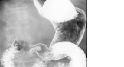 Kontrastmitteluntersuchungen von Magen, Darm, Nieren und Venen