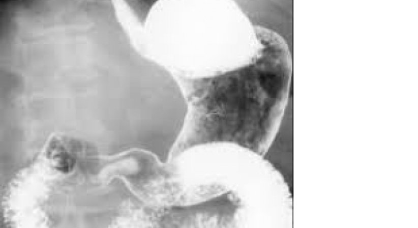 Kontrastmitteluntersuchungen von Magen, Darm, Nieren und Venen - Dr. Axel Gebauer - Radiologe Baden 2500