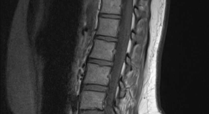 Magnetresonanztomographie - Dr. Axel Gebauer - Radiologe Baden 2500