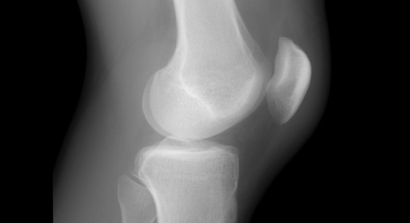 Röntgen - Dr. Axel Gebauer - Radiologe Baden 2500