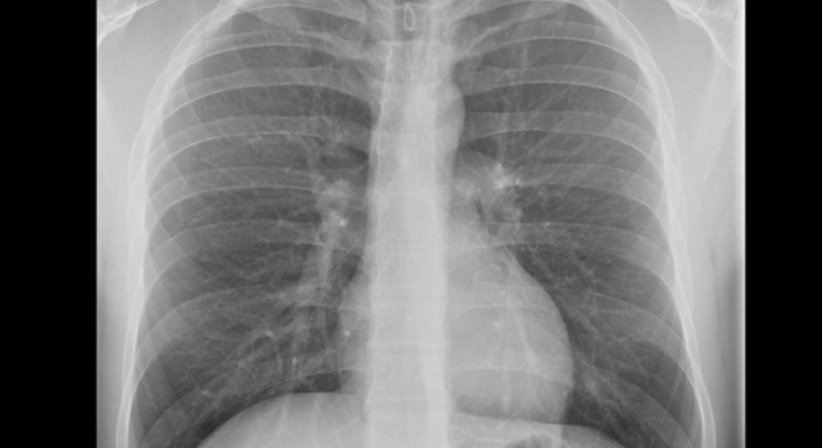 Röntgen - Dr. Axel Gebauer - Radiologe Baden 2500