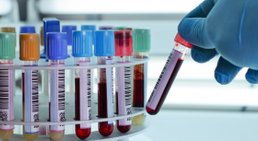 Bluttest -