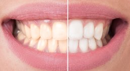 MR Dr. Michael Beinl - Zahnarzt Seitenstetten Markt 3353