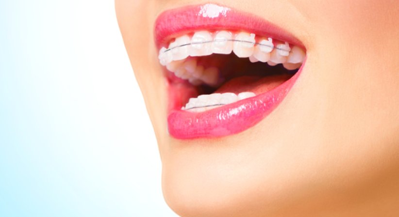 Kieferorthopädie - MR Dr. Michael Beinl - Zahnarzt Seitenstetten Markt 3353