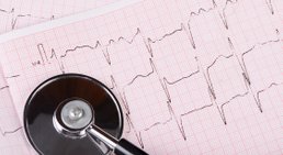 EKG -