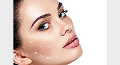 Jünger aussehen mit Fadenlifting