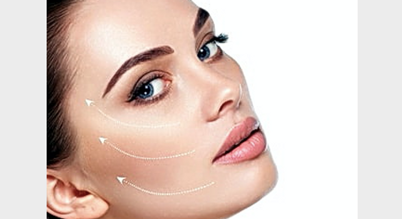 Jünger aussehen mit Fadenlifting - Dr. Babak Mahdavi - Praktischer Arzt Wien 1210