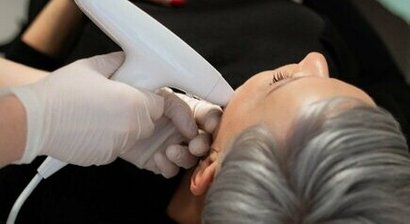 Hautbilderneuerung und Faltenreduktion mit ablativer Radiofrequenz