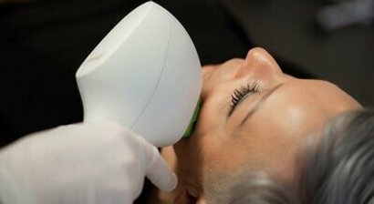 Behandlung von Pigmentflecken und Äderchen