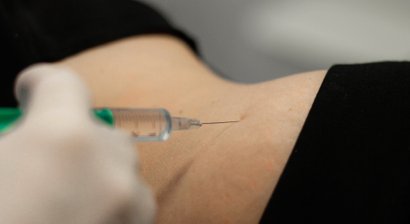 Injektionslipolyse (Fett-weg-Spritze)