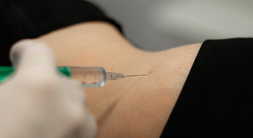 Injektionslipolyse (Fett-weg-Spritze) - Dr. Marion Steiner - Allgemeinchirurgin/Viszeralchirurgin Neusiedl am See 7100