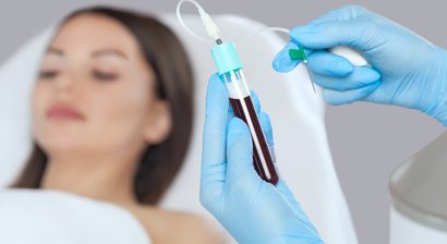 Vampir Lifting (PRP Therapie)