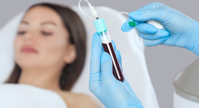 Vampir Lifting (PRP Therapie) - Dr. Marion Steiner - Allgemeinchirurgin/Viszeralchirurgin Neusiedl am See 7100