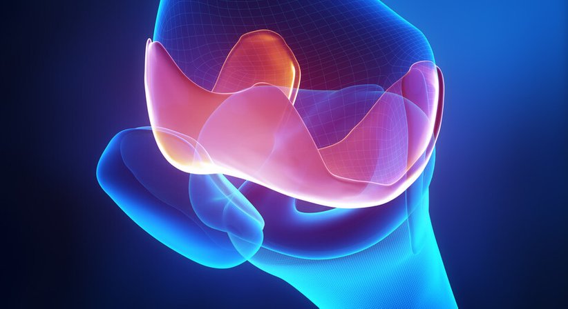 Knieprothese - Univ.Prof. Dr. Christian Gäbler - Unfallchirurg Wien 1090