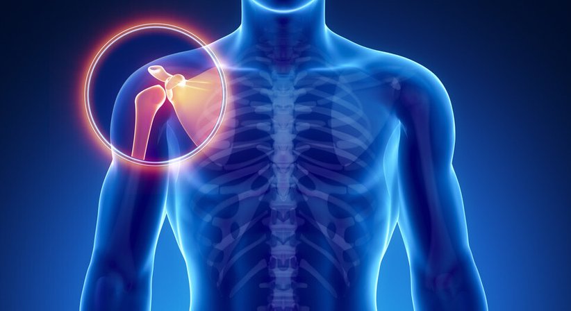 Schulterluxation - Univ.Prof. Dr. Christian Gäbler - Unfallchirurg Wien 1090