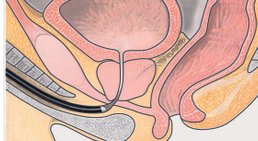 OA Dr. Oleg Kheyfets, F.E.B.U. - Urologe Wien 1010