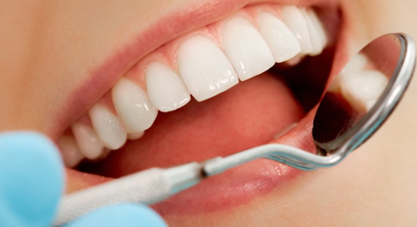 Invisalign - Dr. Stefan Schragl - Zahnarzt Neunkirchen 2620